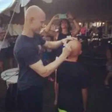 alopeciapalooza