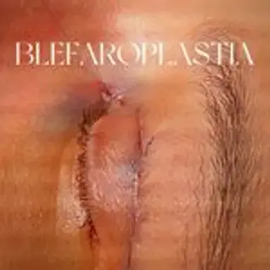 blefaroplastia