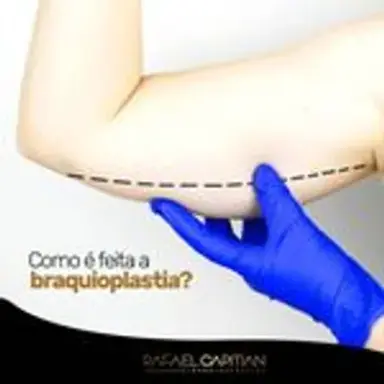 braquioplastia