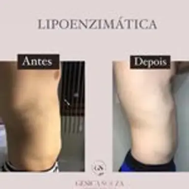 lipoenzimas