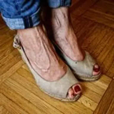 veinyfeet